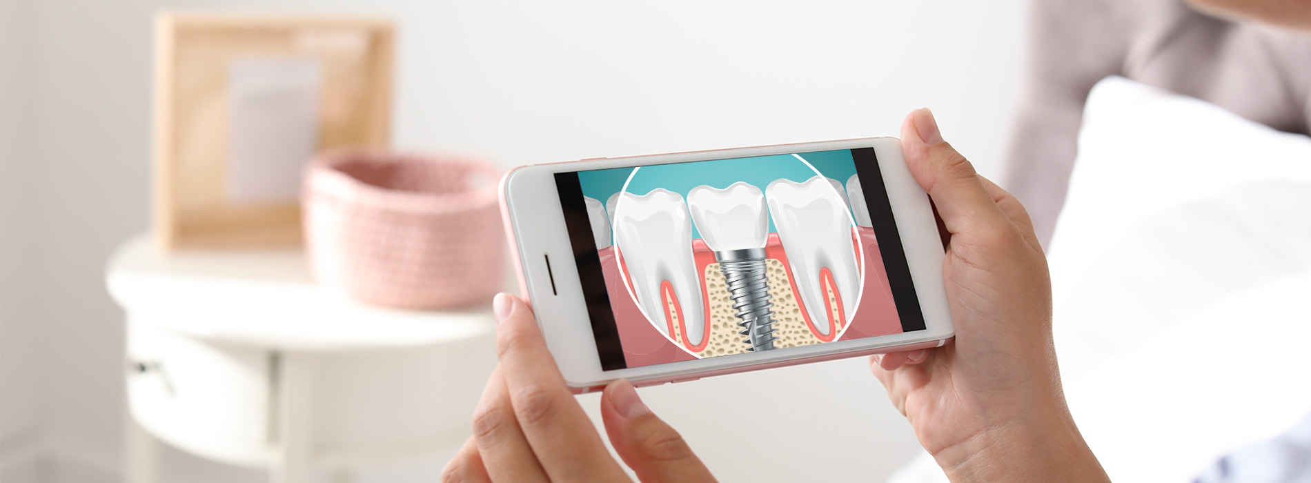 Buck Dental Health Associates | Crowns, Dental Cleanings and All-on-4 reg